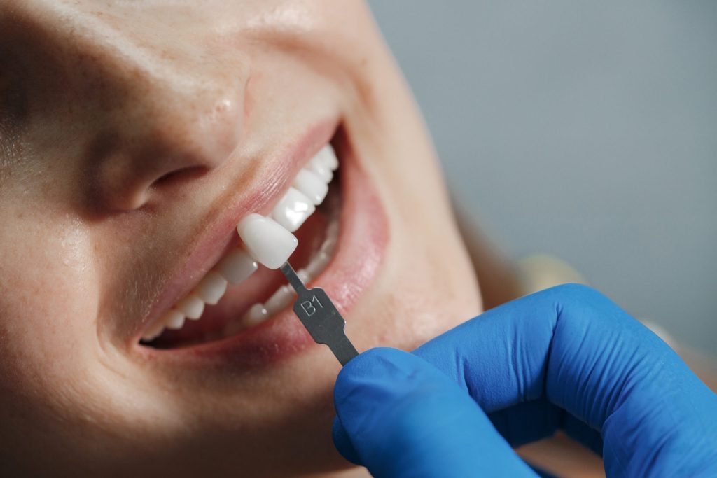 תמונה של טיפול שיניים מרפאת מומחים עדן