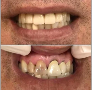 רופא שיניים מומלץ בפתח תקווה